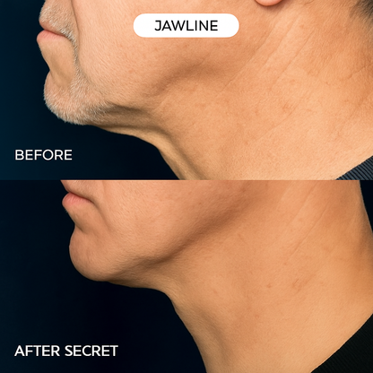 Erase Years of Aging at Home in Just 5 Minutes