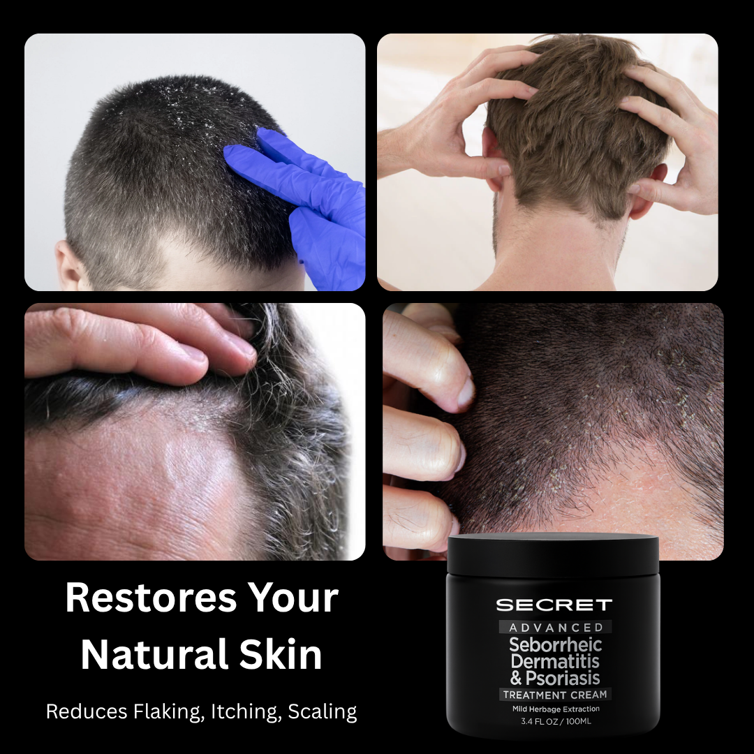 Secret Scalp Relief Balm