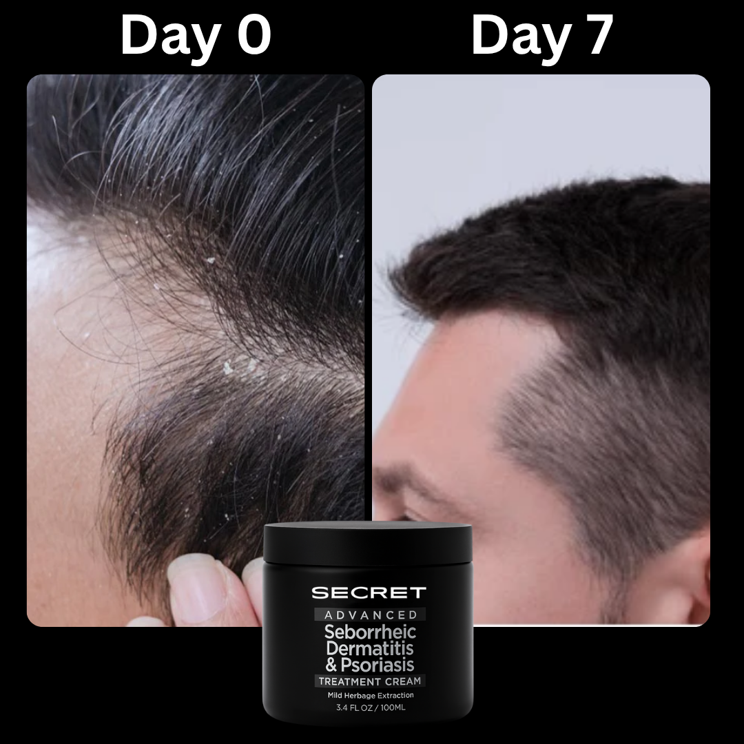 Secret Scalp Relief Balm