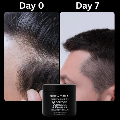 Secret Scalp Relief Balm